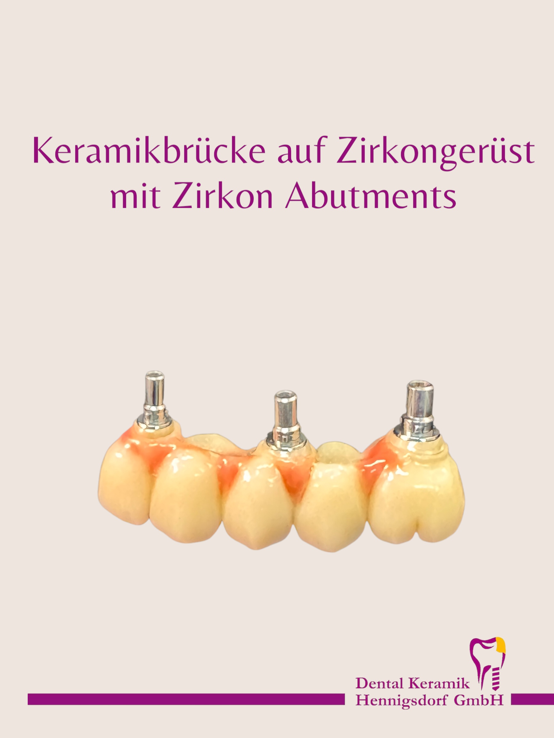 Keramikbrücke